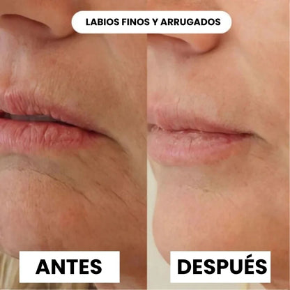 Dile adiós a las arrugas – Mascarilla con Colágeno 100% Natural