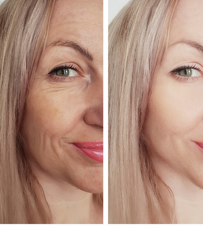 Dile adiós a las arrugas – Mascarilla con Colágeno 100% Natural