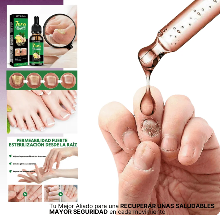 7 DÍAS UÑAS LIBRES DE HONGOS PROTECCIÓN Y ELIMINACIÓN DEL HONGO DE TOS UNAS